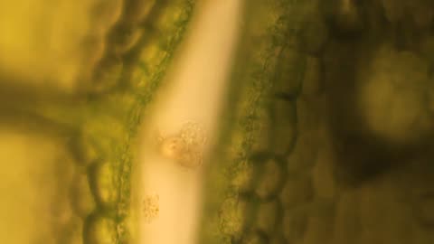 Bdelloid Rotifer on Plant