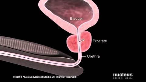 What is the Prostate Gland in Men