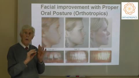 Does Changing the Mouth, Oral Posture Alter the Growth of the Face by Prof John Mew