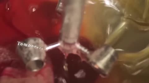 HOW GUMMY CANDY IS MADE