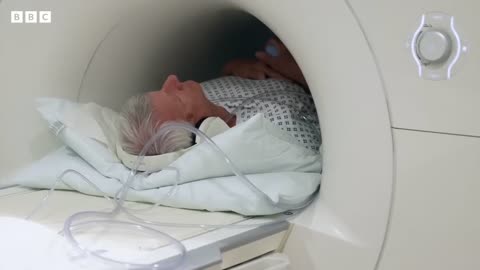 Can MRI scans screen men for prostate cancer_ - BBC News