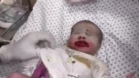 israel targeting of babies in gaza