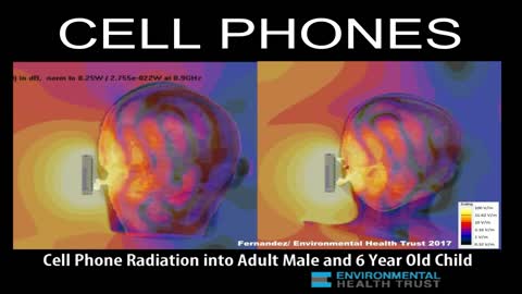 Wireless Cell Phone Radiation Penetrates The Brain: Scientific Imaging