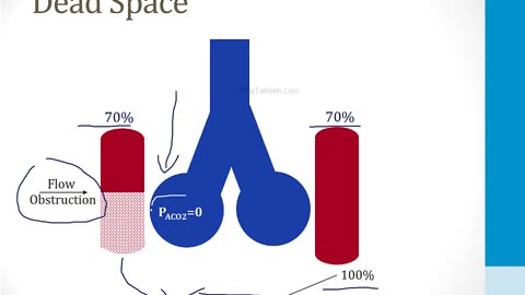 Pulmonary - 1. Embryology, Anatomy and Physiology - 6.Ventilation and Perfusion