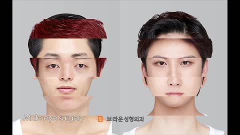MALE PLASTIC SURGERY BEFORE AND AFTER : BRAUN PLASTIC SURGERY IN KOREA