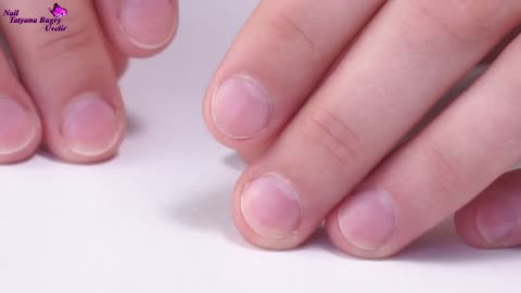 Incredible Nail Transformation | French Manicure | How to do a French tip Manicure