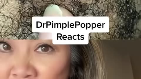 Dr Pimple Popper Needs a SPLASH SCREEN! #DPPReacts