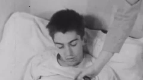 1949 Before and After Lobotomy