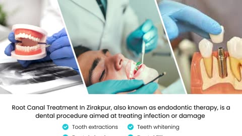 Best Root Canal Treatment In Zirakpur