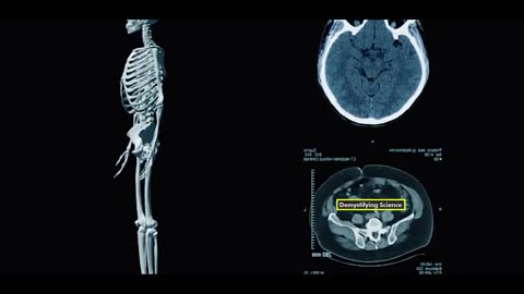 CT Scan: Why CT Scan is performed