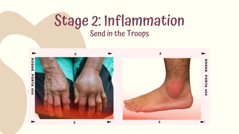 Four Stages of Healing