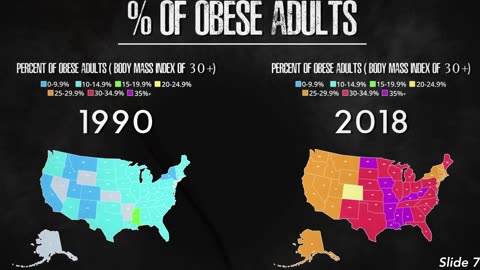 Obesity Today is Widespread