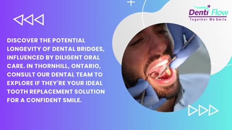 Benefits of Dental Bridges