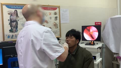 Doctor Removes Slithering Parasite from Man's Nose