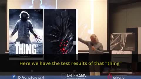 Must Watch - Life Forms Found In Pfizer COVID "Vaccines" - Dr Franc Zalewski