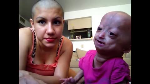 Twins - Adalia Rose