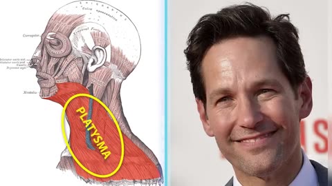 Paul Rudd: All Natural? | Plastic Surgery Analysis