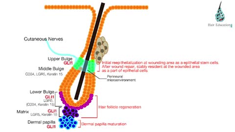 Will RCH 01 Baldness end by 2020? -by DR.ASHOK