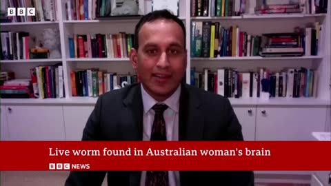 Live Worm found in Australian woman's brain