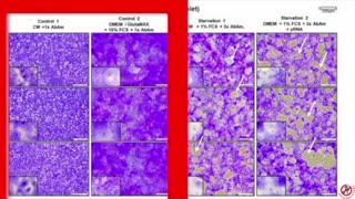 The End of Germ Theory? Testing The Tests