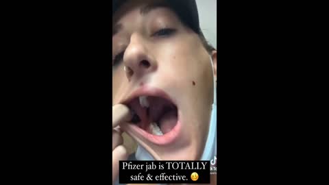 Vaxxed Lady Develops Huge Busted Blood Vessels Inside Mouth and On Body