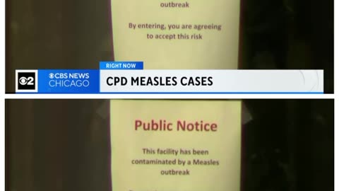 Apparent measles outbreak inside Chicago Police District