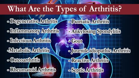 Arthritis Treatment in Castle Rock