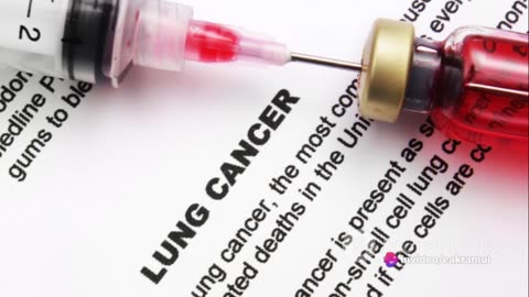 New Lung Cancer Screening Guidelines: What You Need to Know