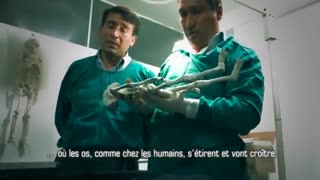Peru's Aliens [5] Scientists examine the mummified bodies