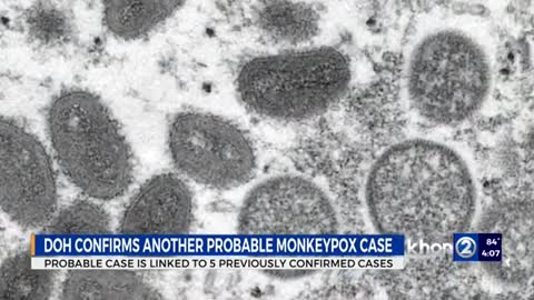 DOH reports one additional probable monkeypox case