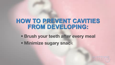 how to brush your teeth - fight tooth decay