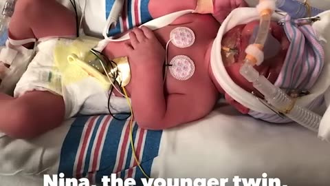 Identical twin sisters meet for 1st time nearly 1 year after birth
