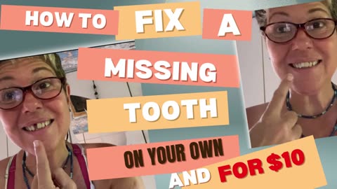 How To Fix A Missing Tooth On Your Own