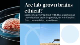 Are Lab-Grown Brains Ethical? According to Scientists, There Is No No-Brainer Answer