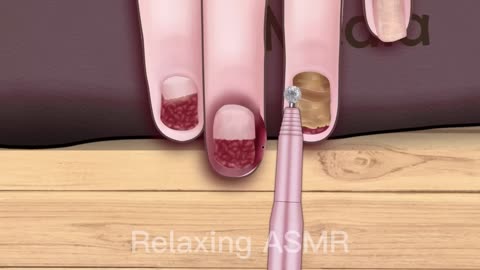 ASMR The best treatment swollen fingers, ingrown nails for beautiful girls