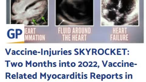 Vaccine-Injuries SKYROCKET: Two Months into 2022, Vaccine-Related Myocarditis Reports