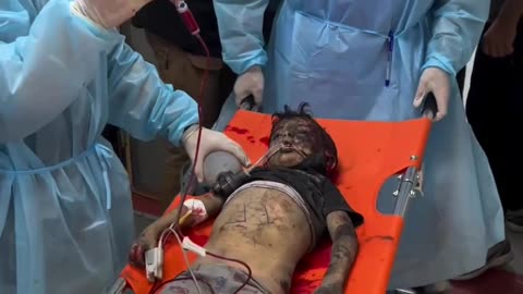 Child casualties of Israeli bombing in Gaza hospital