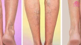 Veniselle Review - The best leg care cream by healthuser