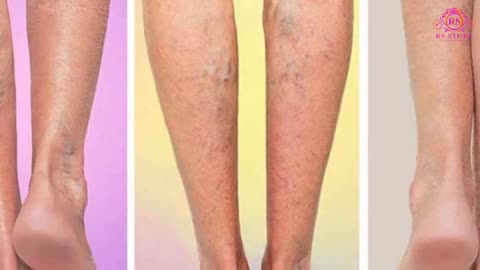 Veniselle Review - The best leg care cream by healthuser