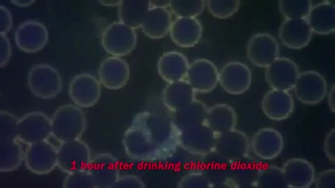 CI02:CHLORINE DIOXIDE AKA MMS/CDS AND THE BENEFITS WHEN USED TO TREAT DISORDERS OF BLOOD VISCOSITY