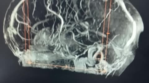 MRI Brain 🧠🧠🧠🧠🧠 ||Official Nazim Siddiqui