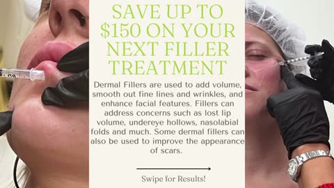 Rejuvenate Your Face with a Face Lift