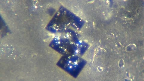 5G nanochip found in Pfizer c-19 jab under 200x magnification