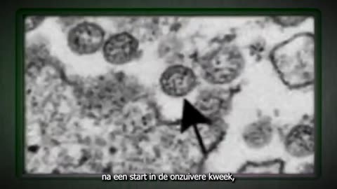 Afscheid van virologie - deel 1 (Nederlands ondertiteld)