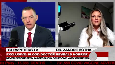 !!!Dr. Zandre Botha reveals horrific findings in the ''covid'' vials (4 oct. 2021)