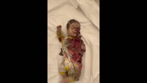 Brutality of israel's indiscriminate bombing in Gaza - A dead baby, internal organs visible. *NSFW