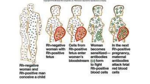 The RH Negative Blood Type: Differences