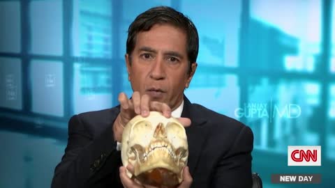 Dr. Sanjay Gupta Examines Bob Saget's Autopsy Report: 'This Was Not a Sort of Simple Bump'