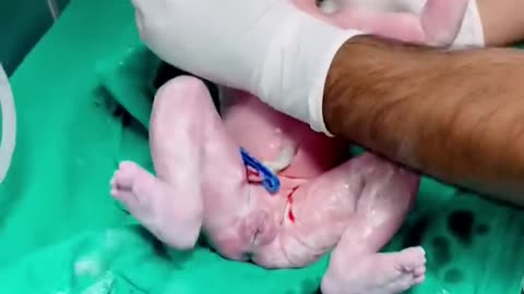 Newborn baby birth at first crying 😘😘😘