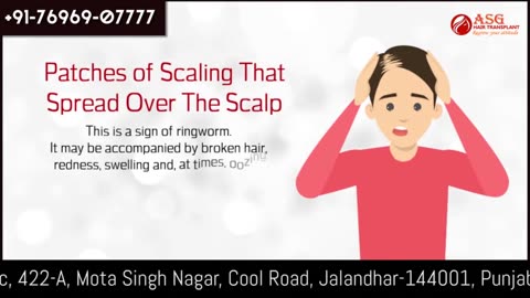 Signs and Symptoms of Hair Loss